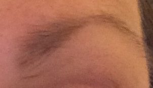 Eyebrow nearly 3 months on.